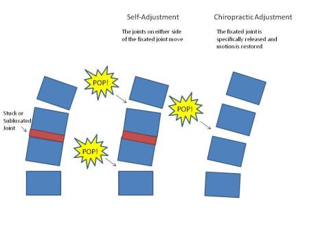 Chiropractic versus self-adjusting